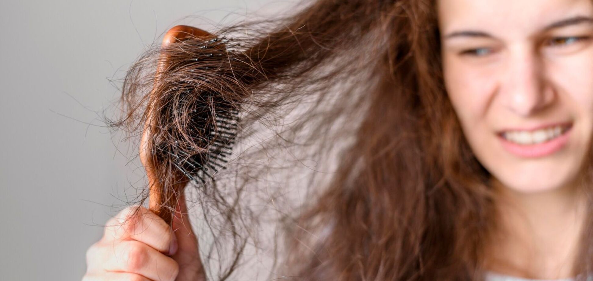 Профілактика випадіння волосся: домашні засоби, які працюють