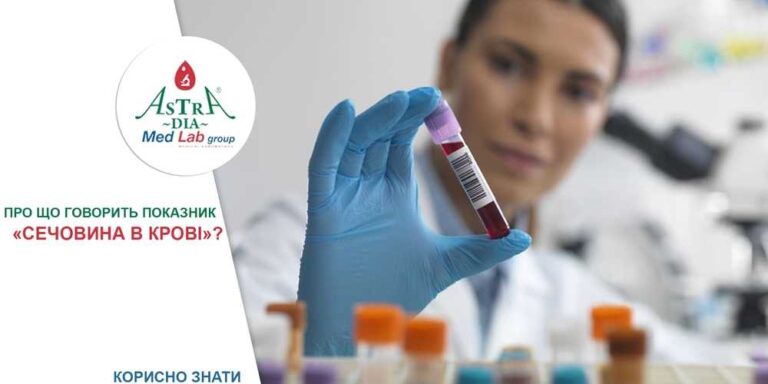 Як правильно розшифрувати аналіз на сечовину і креатинін
