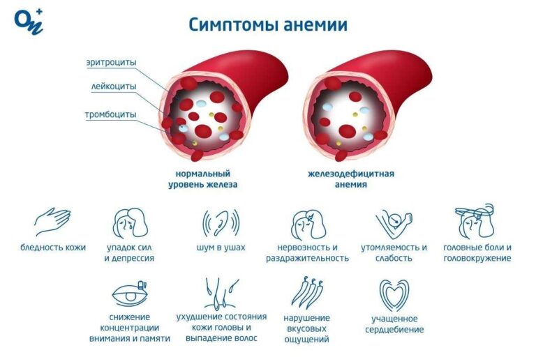 Причины и лечение анемии у взрослых