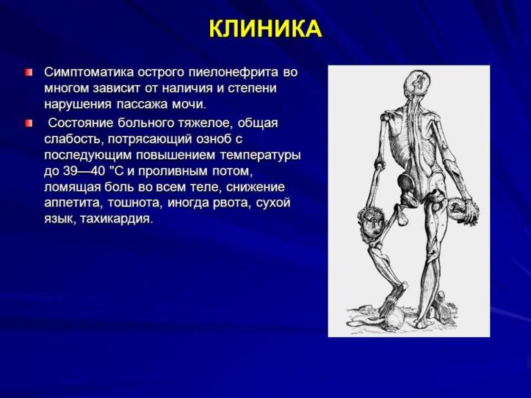 Симптоми та лікування гострого пієлонефриту