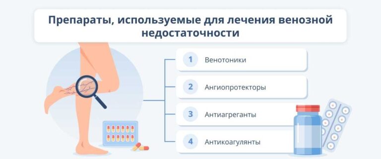 Ознаки та лікування хронічної венозної недостатності