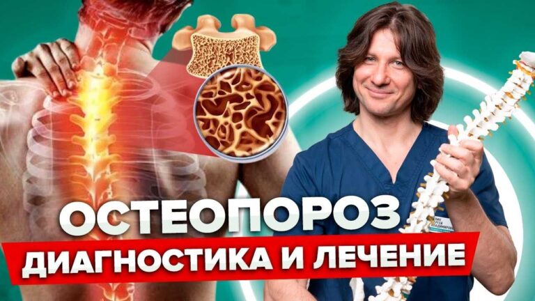 Що таке остеопороз і як його запобігти