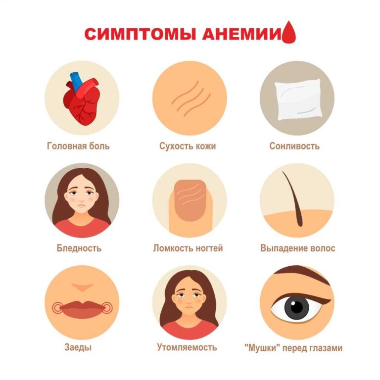 Ознаки анемії у підлітків та її лікування