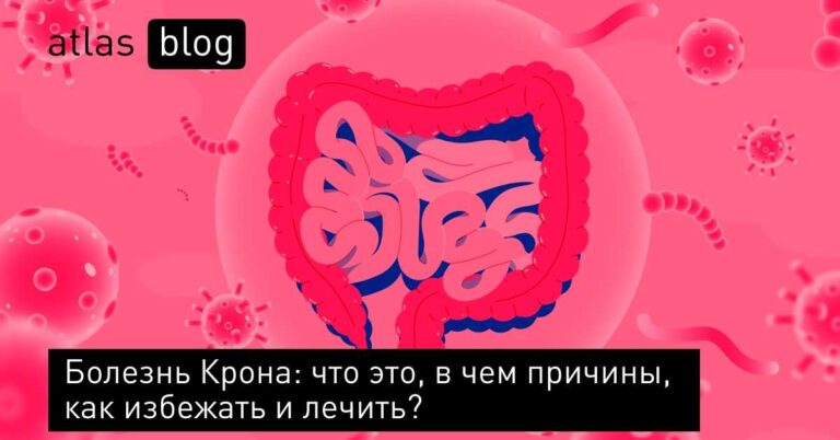 Что такое болезнь Крона: симптомы и методы лечения