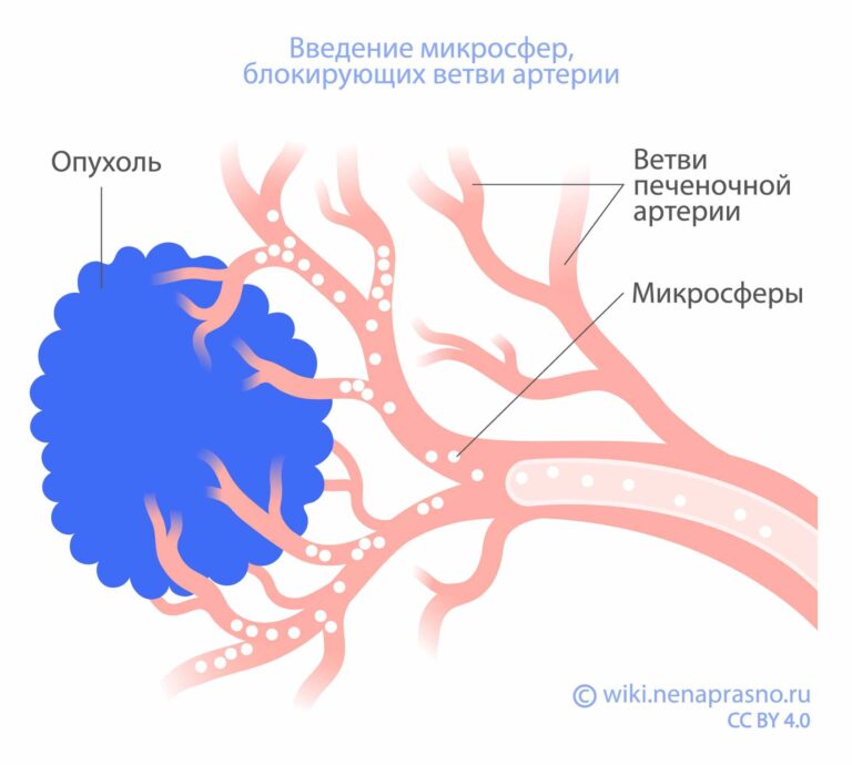 Что такое таргетная терапия и как она помогает при онкологии