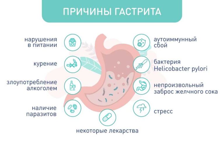 Симптомы и лечение хронического гастрита