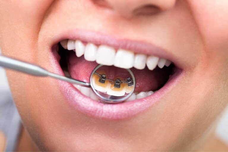 Що можна придбати в OrthoSmiles: огляд асортименту для ортодонтів