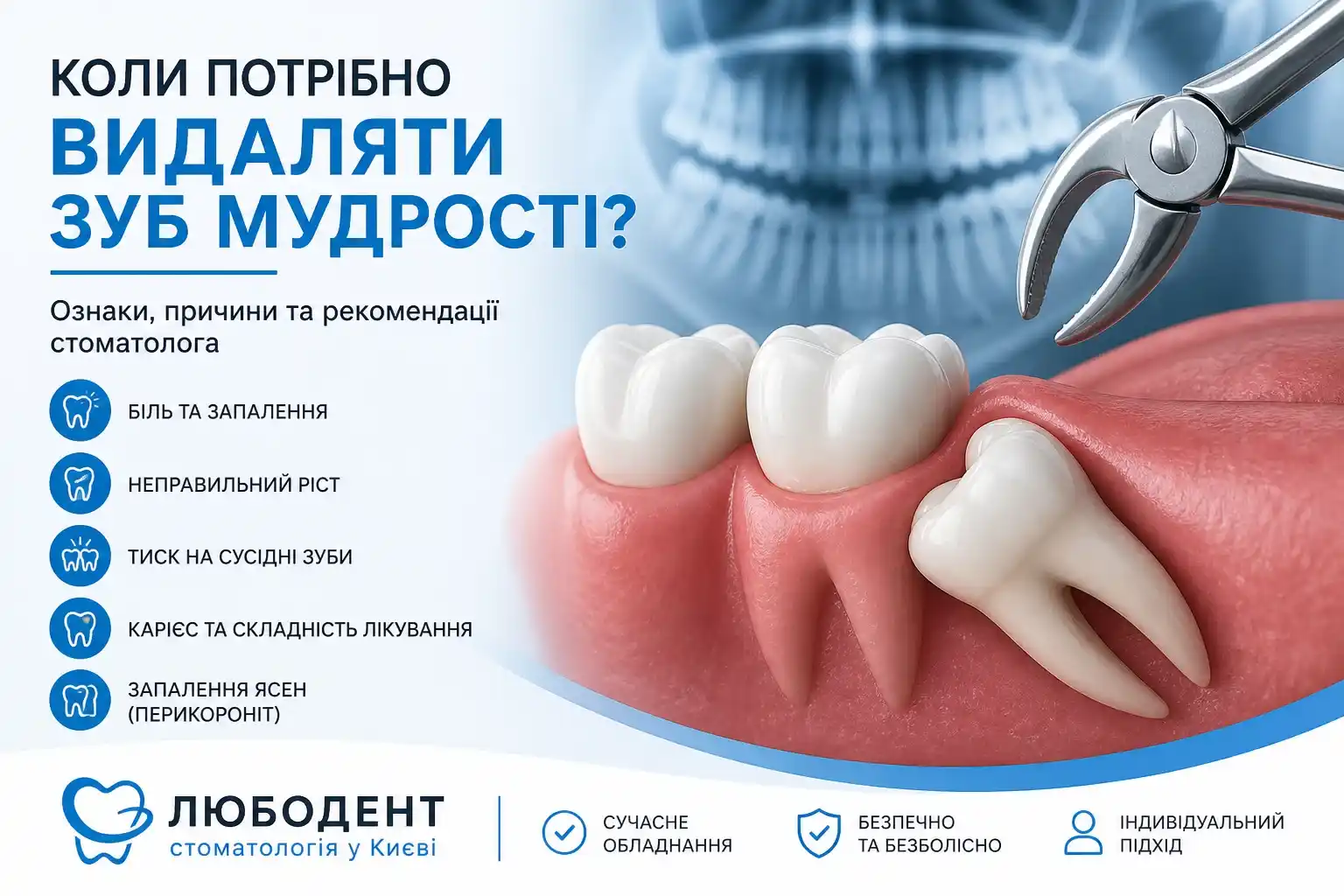 Коли потрібно видаляти зуб мудрості: показання та поради стоматолога