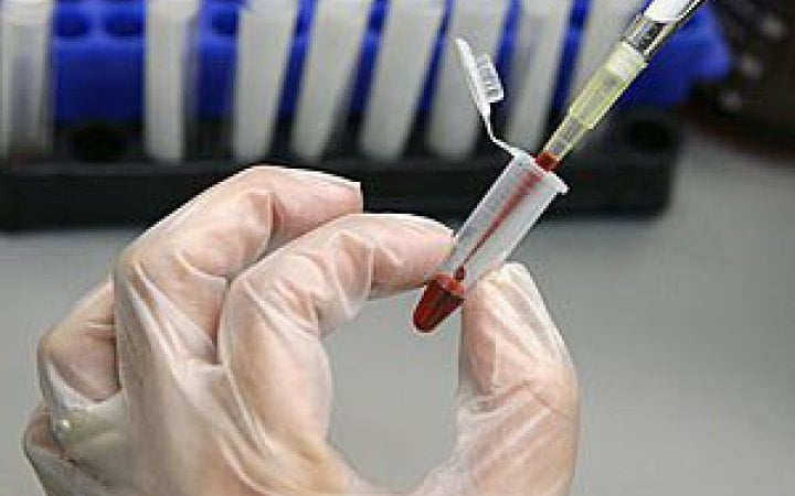 В Україні два роки поспіль не реєструють випадків холери, — ЦГЗ