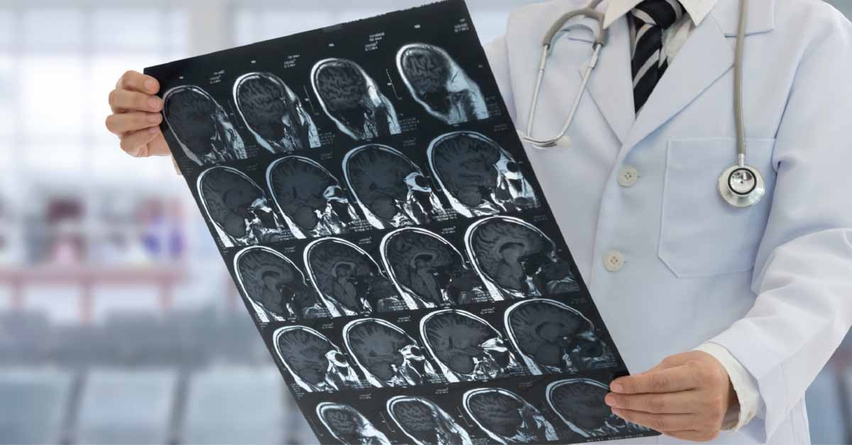 Оніміння рук і ніг: можливі причини та коли потрібно звернутися до невролога